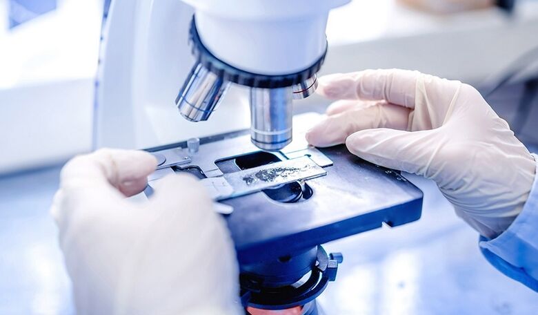 Εργαστηριακή διάγνωση μύκητα νυχιών