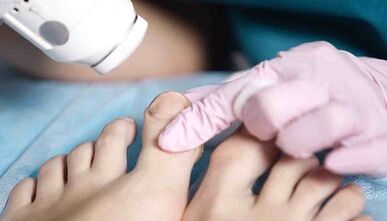 Επεξεργασία υλικού των μανιταριών στα πόδια