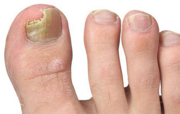 Διαφορετικές μορφές μανιταριών