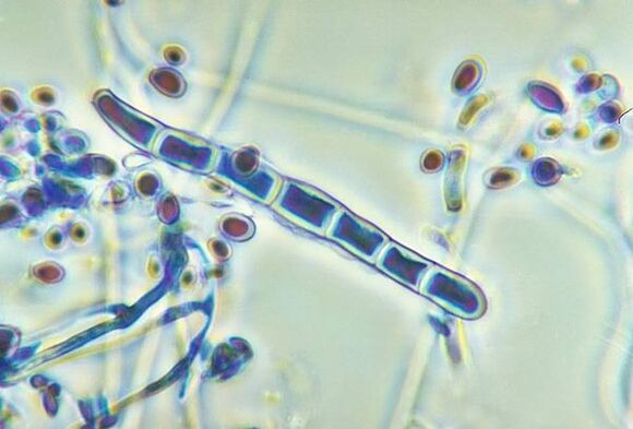 Μανιτάρι Trichophyton rubrum κάτω από το μικροσκόπιο