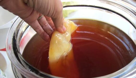 Kombucha για τη θεραπεία του μύκητα των νυχιών
