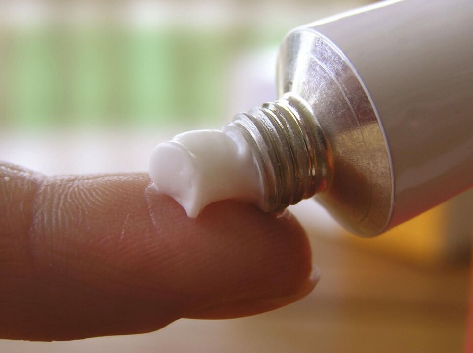 Αλοιφή για τη θεραπεία του μύκητα των νυχιών